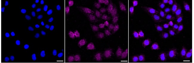 100UL GFPT1 RMAB 100 UL