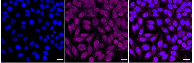 100UL HISTONE H2B RMAB 100 UL