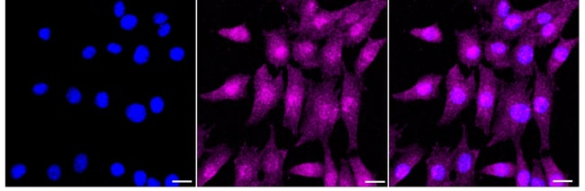 100UL LHX3 RMAB 100 UL