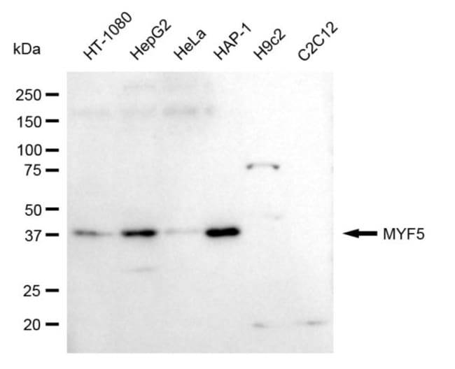 100UL MYF5 RMAB 100 UL