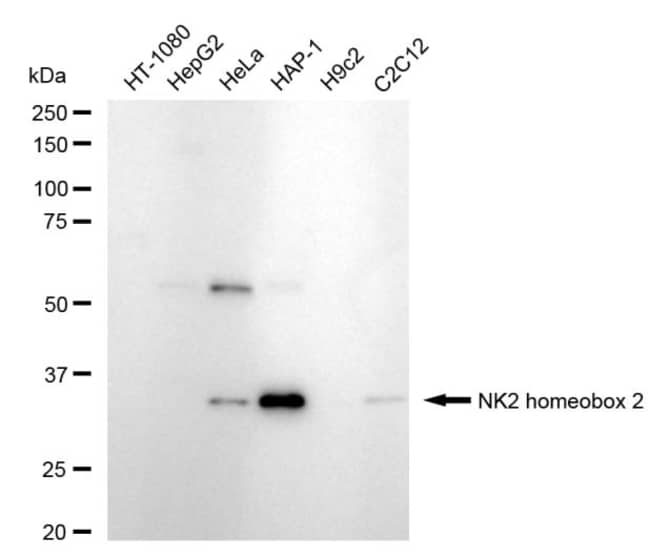 100UL NKX2.2 RMAB 100 UL