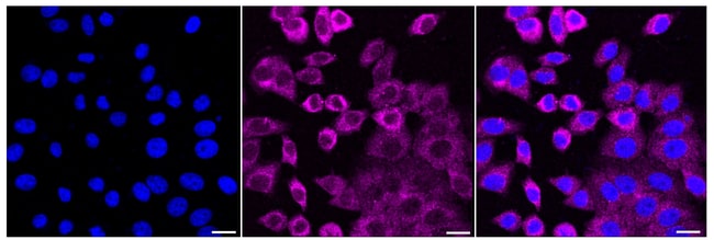 100UL OXYTOCIN RECEPTOR RMAB 100 UL
