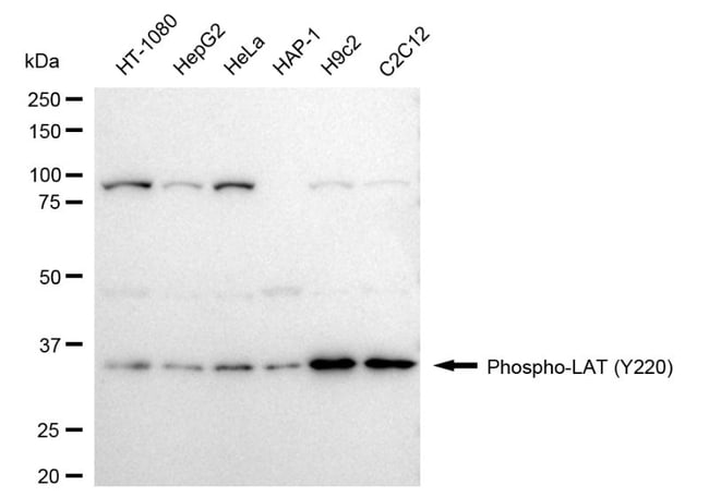 100UL PHOSPHO-LAT (TYR220) RMAB 100 UL