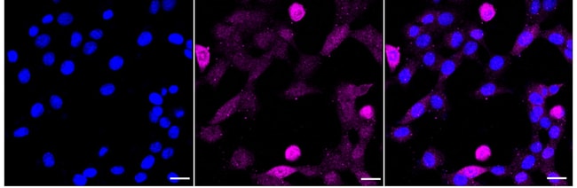 100UL PHOSPHO-P130 (THR986) RMAB 100 UL