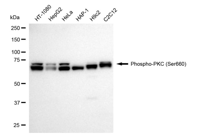 100UL PHOSPHO-PKC PAN (SER660) RMAB 100