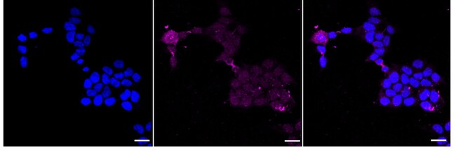 100UL PHOSPHO-PRKD2 (SER876) RMAB 100 UL