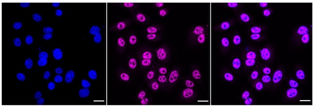 100UL PHOSPHO-PTS (SER19) RMAB 100 UL