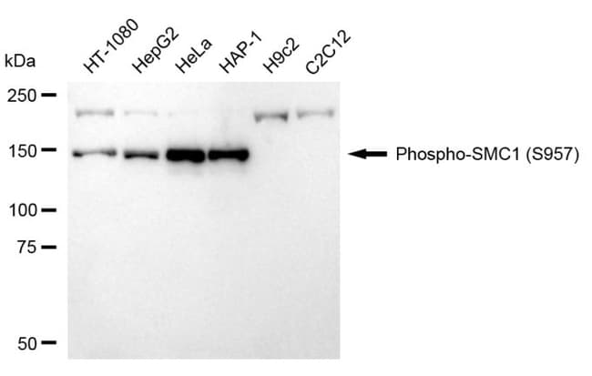 100UL PHOSPHO-SMC1 (SER957) RMAB 100 UL