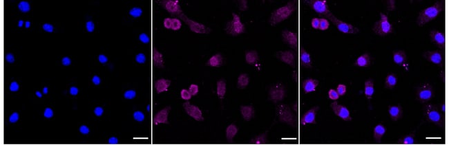 100UL PLEIOTROPHIN RMAB 100 UL