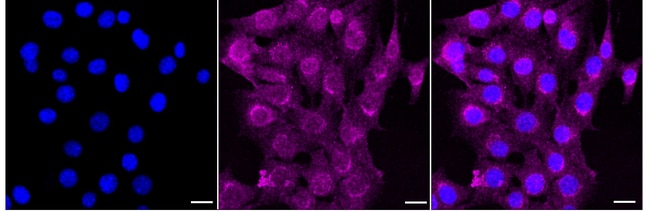 100UL AMPK GAMMA-1 RMAB 100 UL