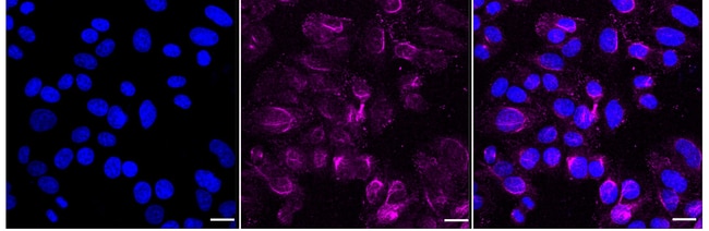 100UL PSMC4 RMAB 100 UL