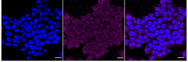 100UL RAD51D RMAB 100 UL