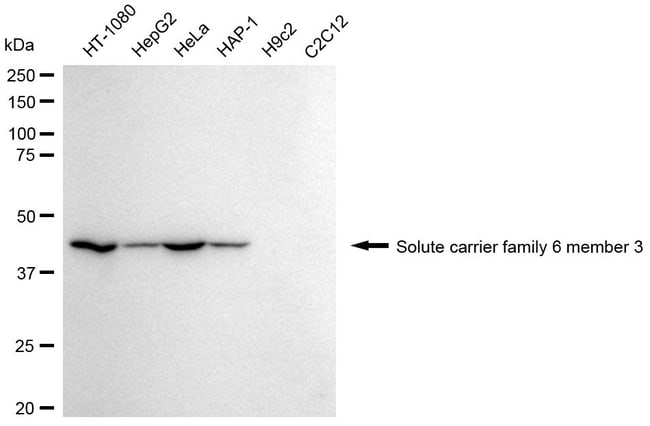 100UL DOPAMINE TRANSPORTER RMAB 100 UL