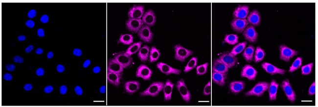 100UL SCP2 RMAB 100 UL