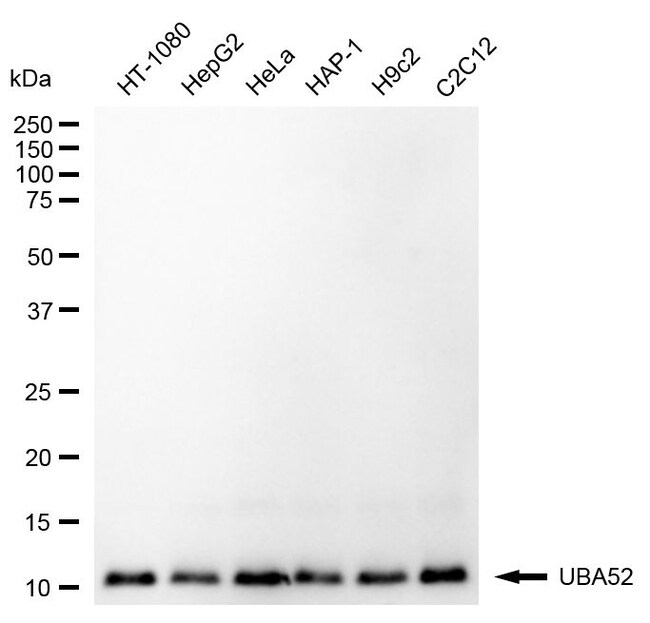 100UL UBA52 RMAB 100 UL