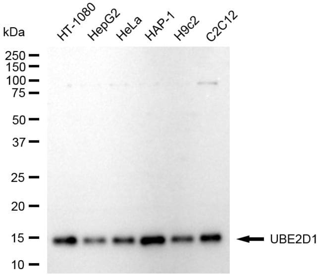 100UL UBE2D1 RMAB 100 UL