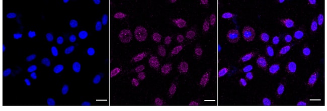 100UL PLACENTAL ALKALINE PHOSPH RMAB 100