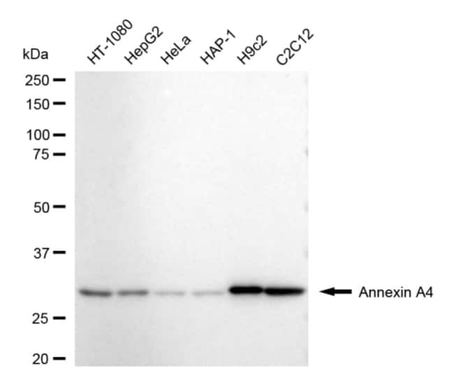 100UL ANNEXIN A4 RMAB 100 UL
