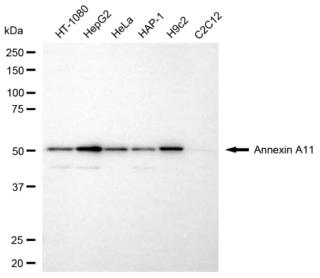 100UL ANNEXIN A11 MAB 100 UL