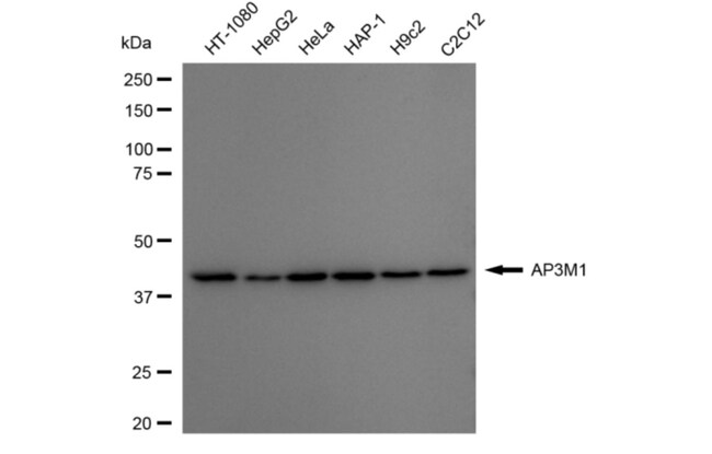 100UL AP3M1 RMAB 100 UL