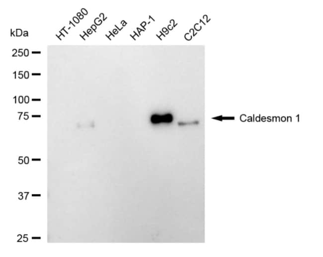 100UL CALDESMON RMAB 100 UL