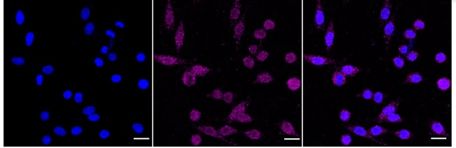 100UL CASPASE 8 RMAB 100 UL
