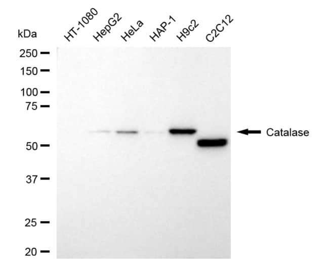 100UL CATALASE RMAB 100 UL