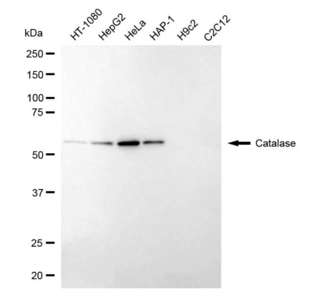 100UL CATALASE RMAB 100 UL
