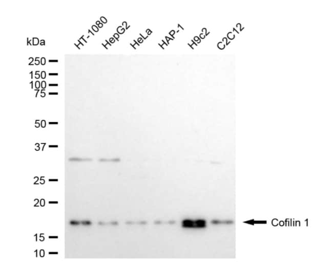 100UL COFILIN RMAB 100 UL