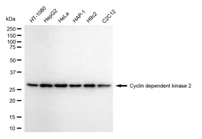 100UL CDK2 RMAB 100 UL