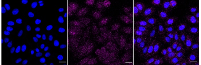 100UL CDK4 MAB 100 UL
