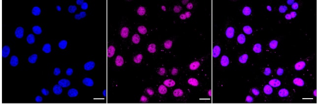 100UL DNMT1 RMAB 100 UL
