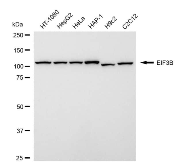 100UL EIF3B RMAB 100 UL