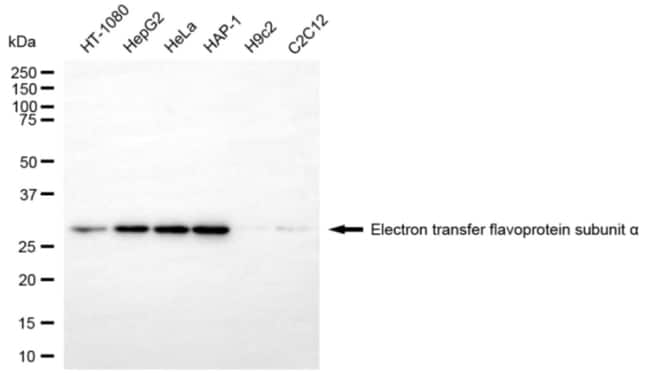 100UL ETFA MAB 100 UL