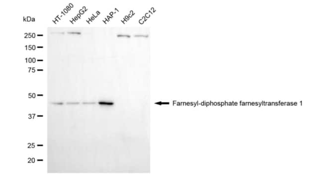 100UL FDFT1 MAB 100 UL