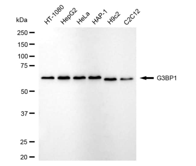 100UL G3BP1 RMAB 100 UL