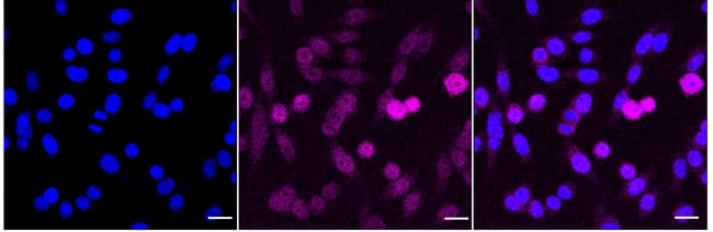 100UL GCLC RMAB 100 UL