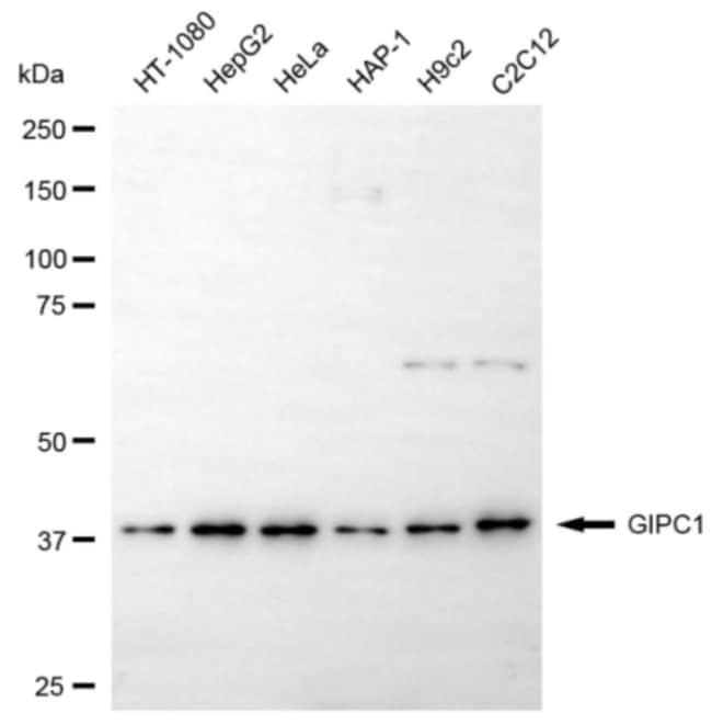 100UL GIPC1 MAB 100 UL