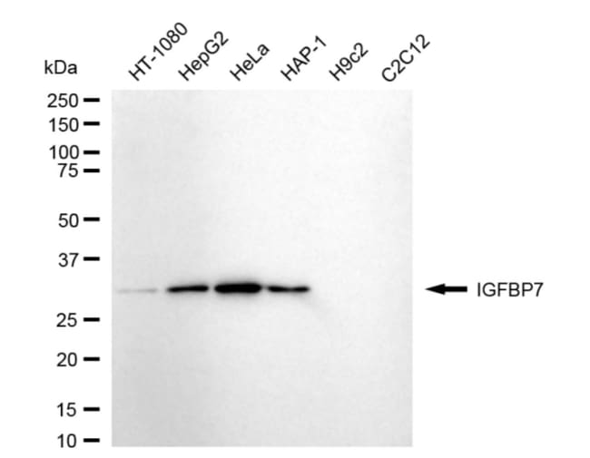 100UL IGFBP7 RMAB 100 UL