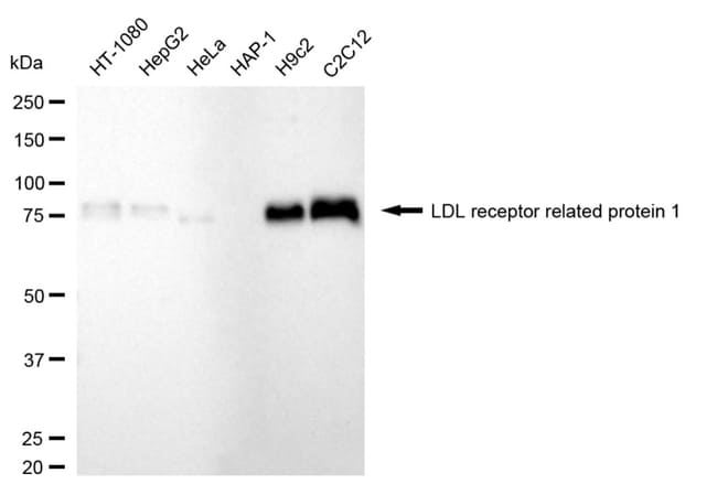 100UL LRP1 RMAB 100 UL