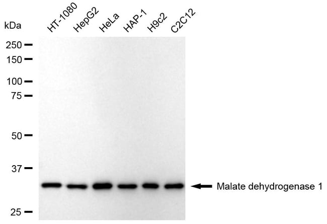 100UL MDH1 RMAB 100 UL