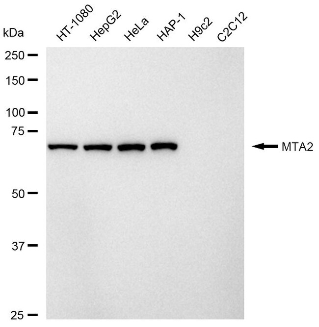 100UL MTA2 RMAB 100 UL