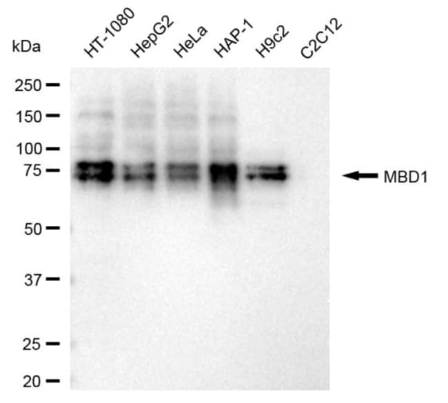 100UL MBD1 RMAB 100 UL