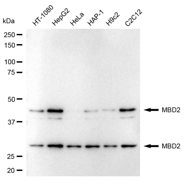 100UL MBD2 RMAB 100 UL