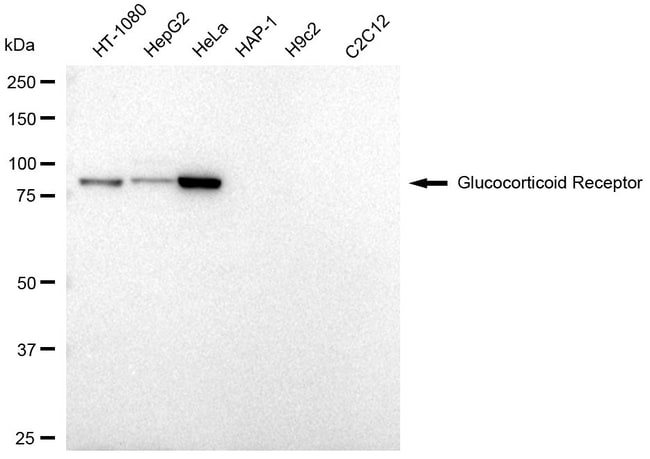 100UL GLUCOCORTICOID RECEPTOR MAB 100 UL