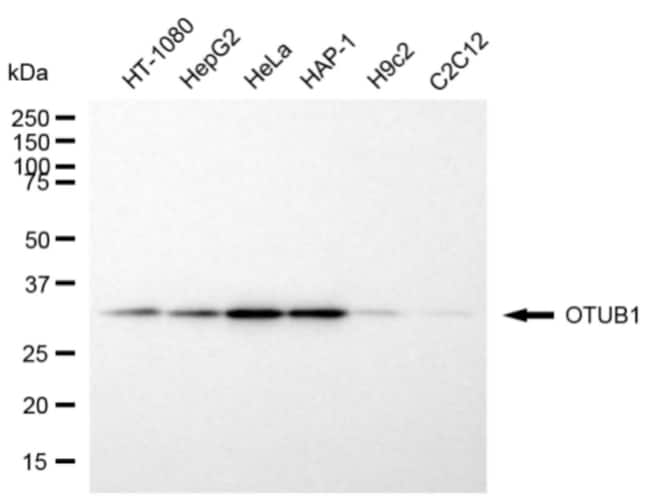 100UL OTUB1 MAB 100 UL