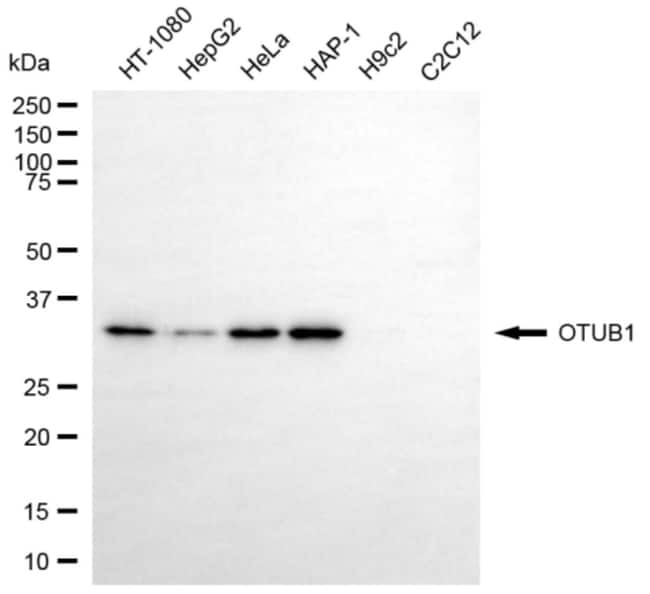 100UL OTUB1 MAB 100 UL