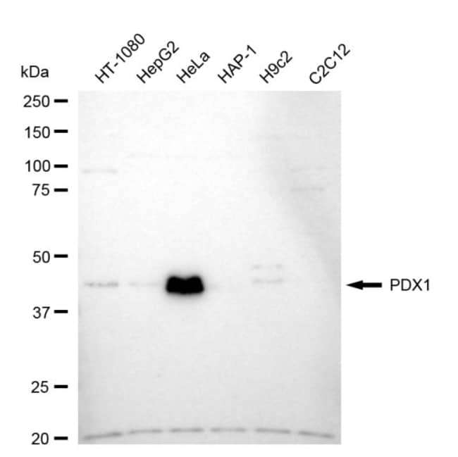 100UL PDX1 RMAB 100 UL