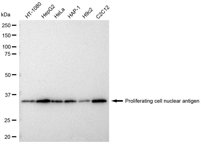 100UL PCNA MAB 100 UL