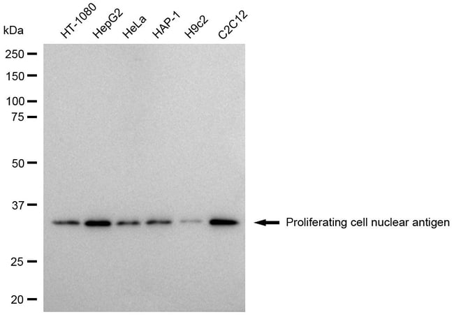 100UL PCNA MAB 100 UL